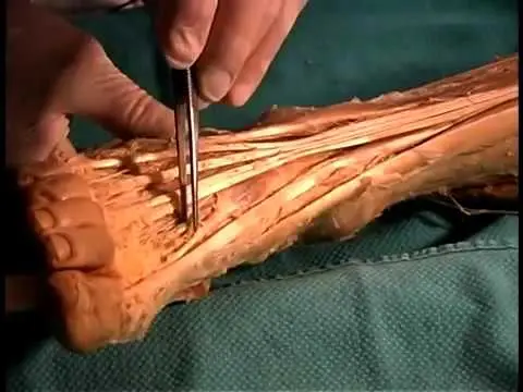 MD Anatomy or Doctor of Medicine in Anatomy